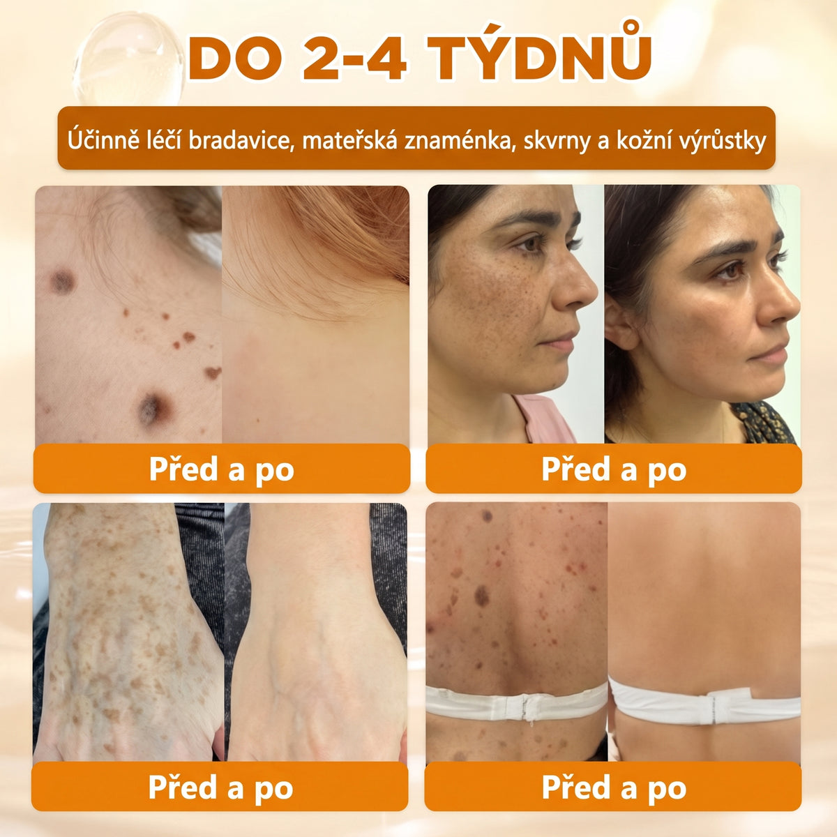 🍯🦿 𝐇𝐞𝐚𝐥𝐫𝐢𝐳𝐞® Včelí jed Komplexní pleťový krém – Nová generace přírodní péče o pleť pro hydratovanější, hladší a zářivější pokožku 🌿✨