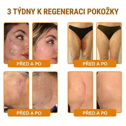 🍯🦿 𝐇𝐞𝐚𝐥𝐫𝐢𝐳𝐞® Včelí jed Komplexní pleťový krém – Nová generace přírodní péče o pleť pro hydratovanější, hladší a zářivější pokožku 🌿✨