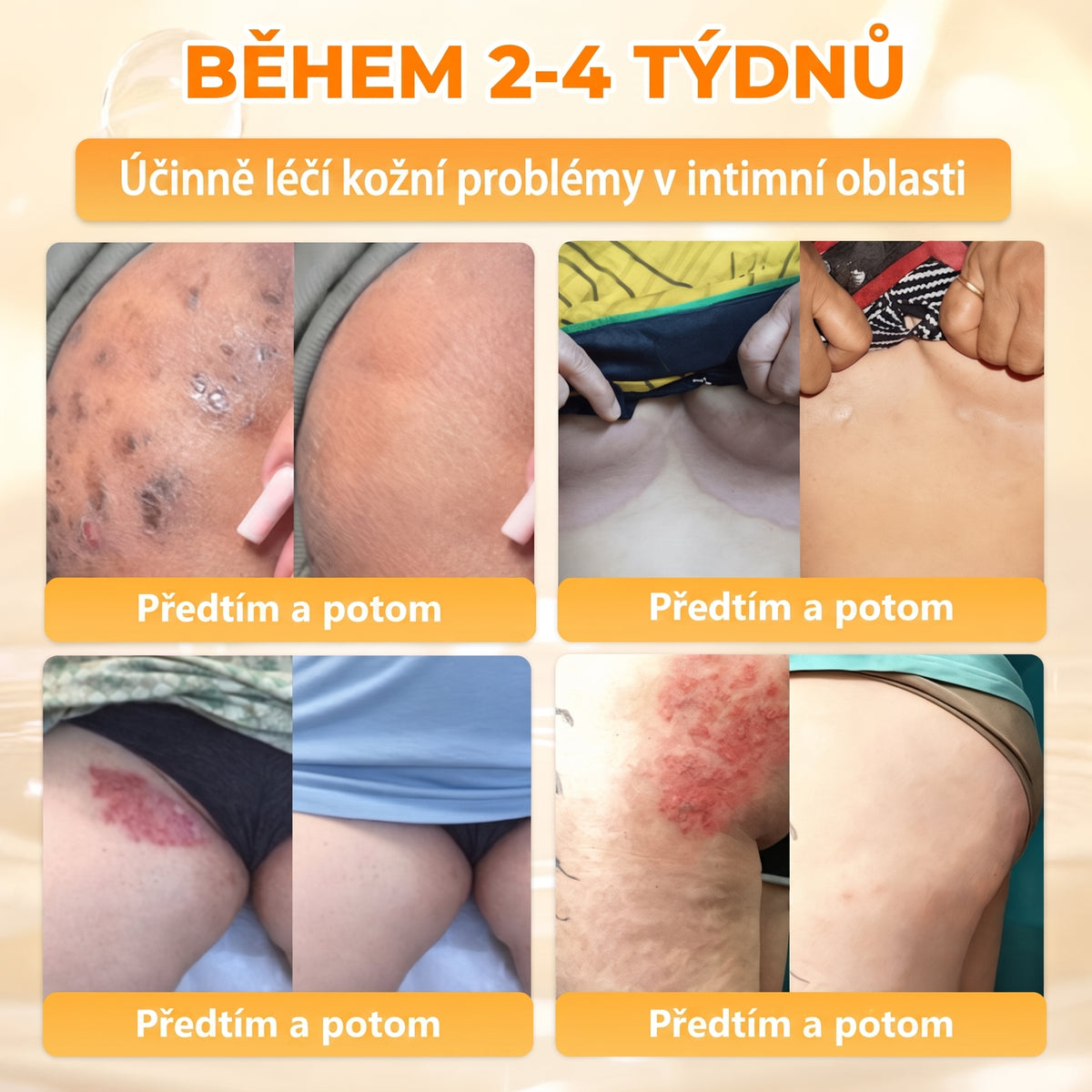 🍯🦿 𝐇𝐞𝐚𝐥𝐫𝐢𝐳𝐞® Včelí jed Komplexní pleťový krém – Nová generace přírodní péče o pleť pro hydratovanější, hladší a zářivější pokožku 🌿✨
