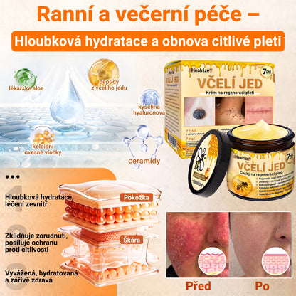 🍯🦿 𝐇𝐞𝐚𝐥𝐫𝐢𝐳𝐞® Včelí jed Komplexní pleťový krém – Nová generace přírodní péče o pleť pro hydratovanější, hladší a zářivější pokožku 🌿✨