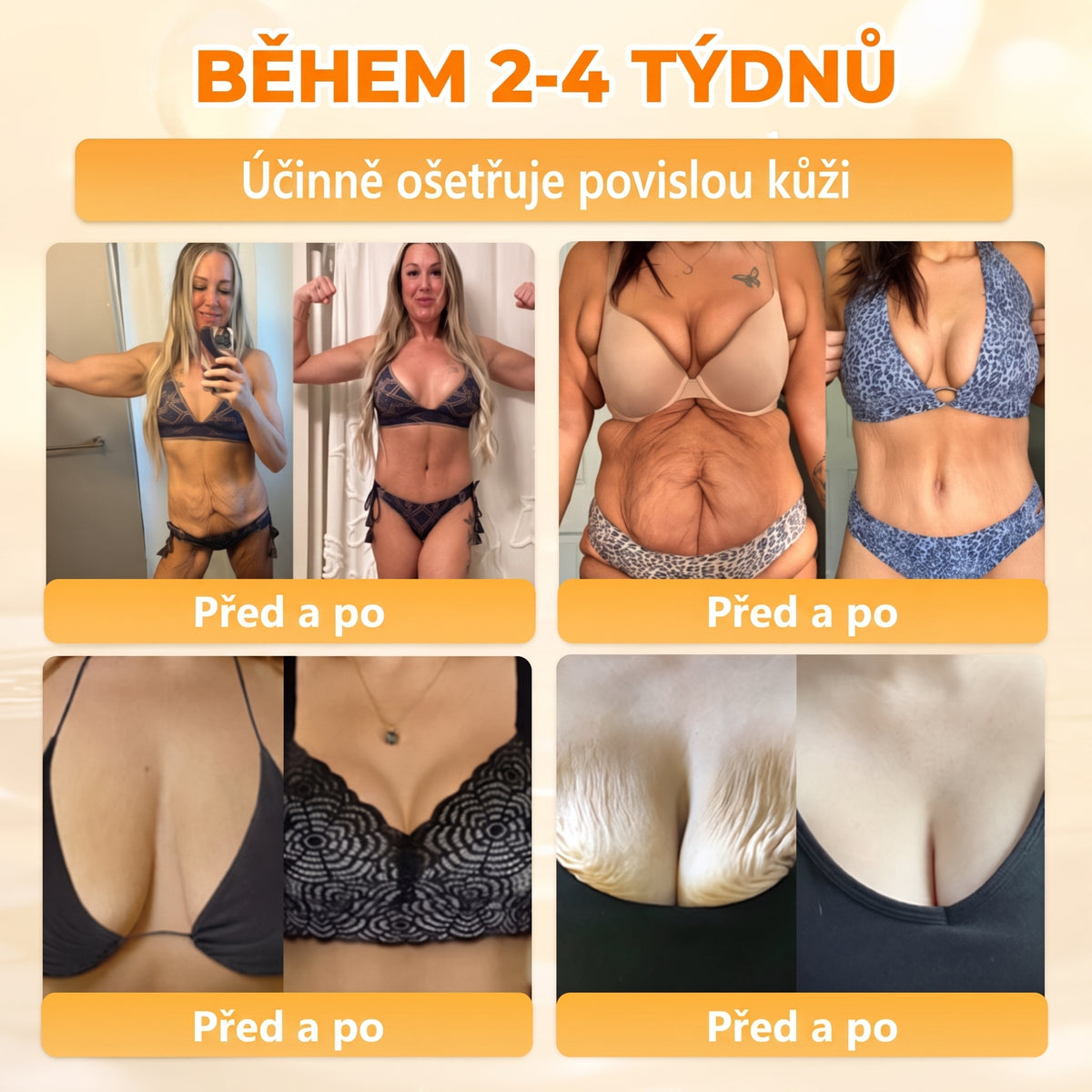 🍯🦿 𝐇𝐞𝐚𝐥𝐫𝐢𝐳𝐞® Včelí jed Komplexní pleťový krém – Nová generace přírodní péče o pleť pro hydratovanější, hladší a zářivější pokožku 🌿✨