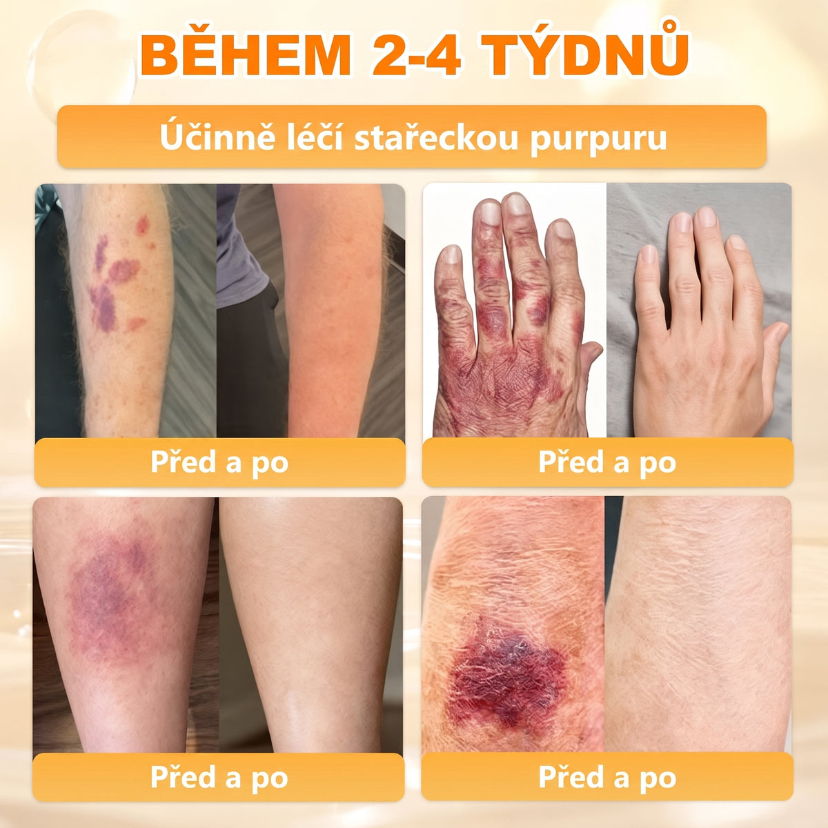 🍯🦿 𝐇𝐞𝐚𝐥𝐫𝐢𝐳𝐞® Včelí jed Komplexní pleťový krém – Nová generace přírodní péče o pleť pro hydratovanější, hladší a zářivější pokožku 🌿✨