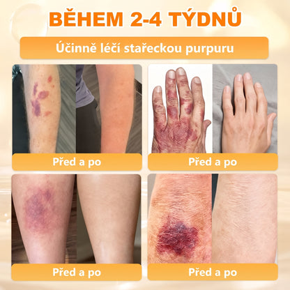 🍯🦿 𝐇𝐞𝐚𝐥𝐫𝐢𝐳𝐞® Včelí jed Komplexní pleťový krém – Nová generace přírodní péče o pleť pro hydratovanější, hladší a zářivější pokožku 🌿✨