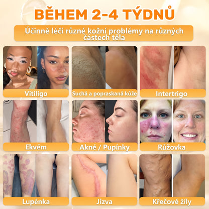 🍯🦿 𝐇𝐞𝐚𝐥𝐫𝐢𝐳𝐞® Včelí jed Komplexní pleťový krém – Nová generace přírodní péče o pleť pro hydratovanější, hladší a zářivější pokožku 🌿✨