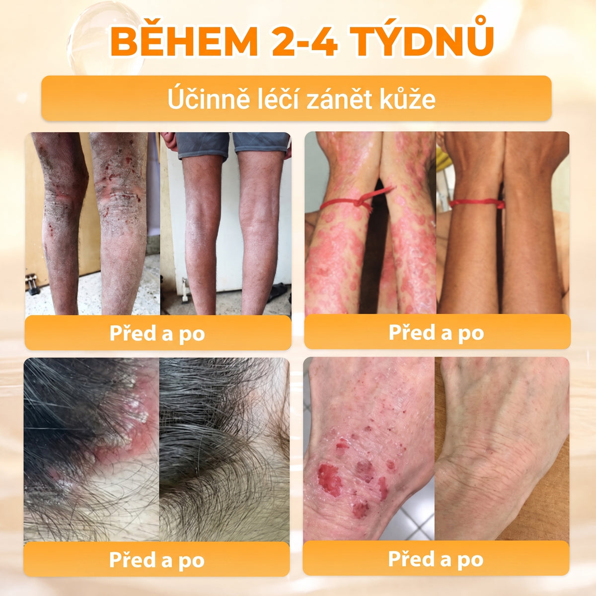 🍯🦿 𝐇𝐞𝐚𝐥𝐫𝐢𝐳𝐞® Včelí jed Komplexní pleťový krém – Nová generace přírodní péče o pleť pro hydratovanější, hladší a zářivější pokožku 🌿✨