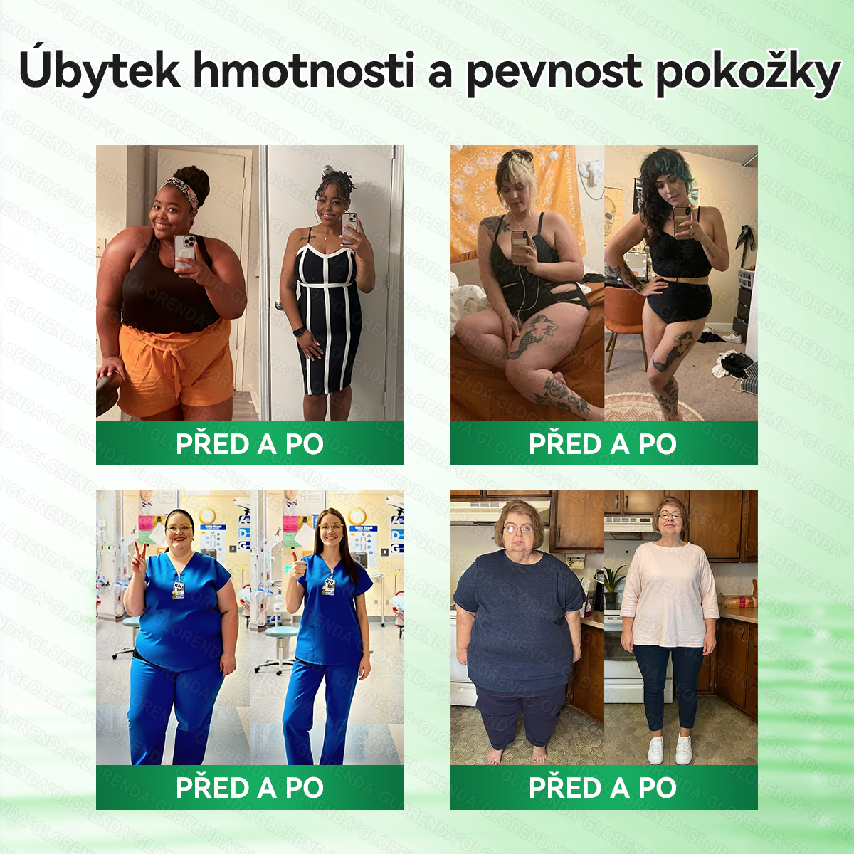 🇨🇿 Oficiální obchod|💚𝑮𝑳𝑶𝑹𝑬𝐍𝐃𝗔® Moringa·Berberin×NAD+10-v-1 Pokročilá Nano Mikronáplňová Náplast (pouze jednou denně, viditelné změny během 7 dní) ✅ Pro osoby s obezitou, povolenou kůží, cukrovkou, spánkovou apnoe, problémy se klouby a dalšími obtížemi.