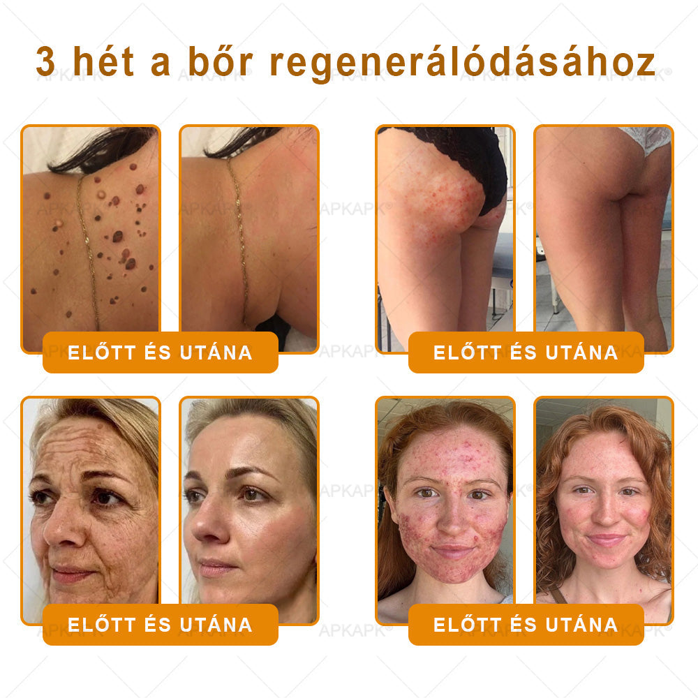 🍯🦿 𝐇𝐞𝐚𝐥𝐫𝐢𝐳𝐞® Včelí jed Komplexní pleťový krém – Nová generace přírodní péče o pleť pro hydratovanější, hladší a zářivější pokožku 🌿✨